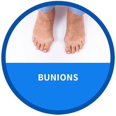Bunions icon