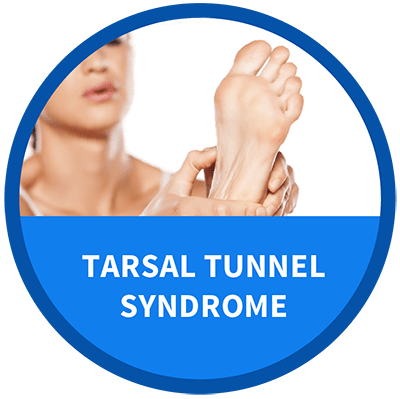 Tarsal Tunnel Syndrome icon