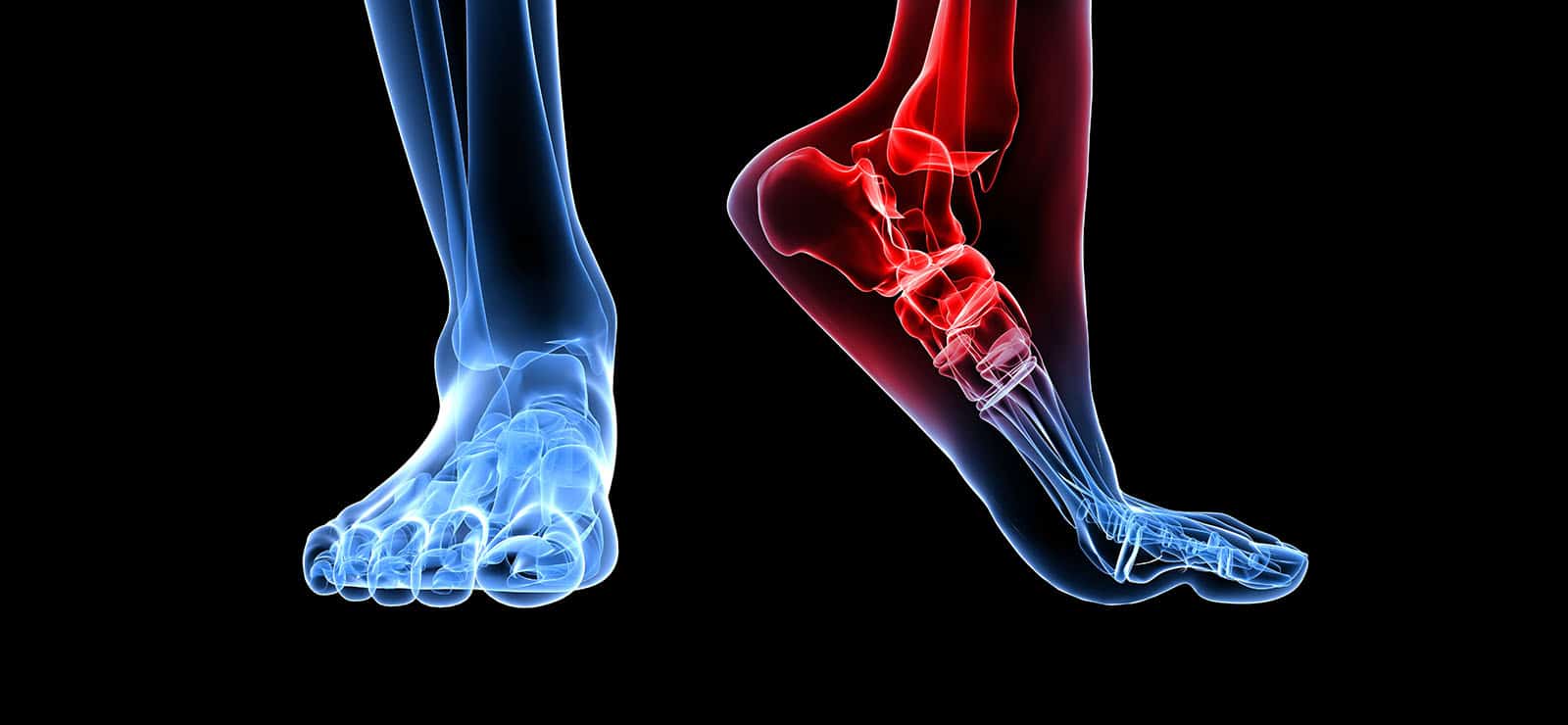 conditions of heel pain