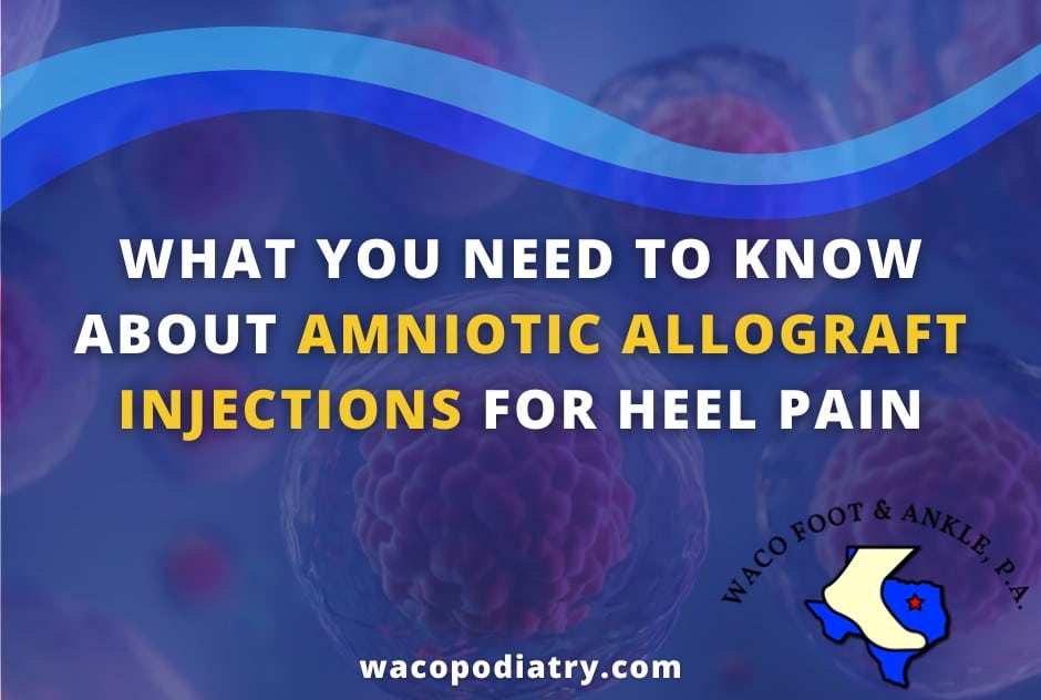 Amniotic allograft injections for heel pain graphic