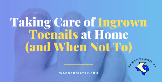 Take Care of Ingrown Toenails at Home